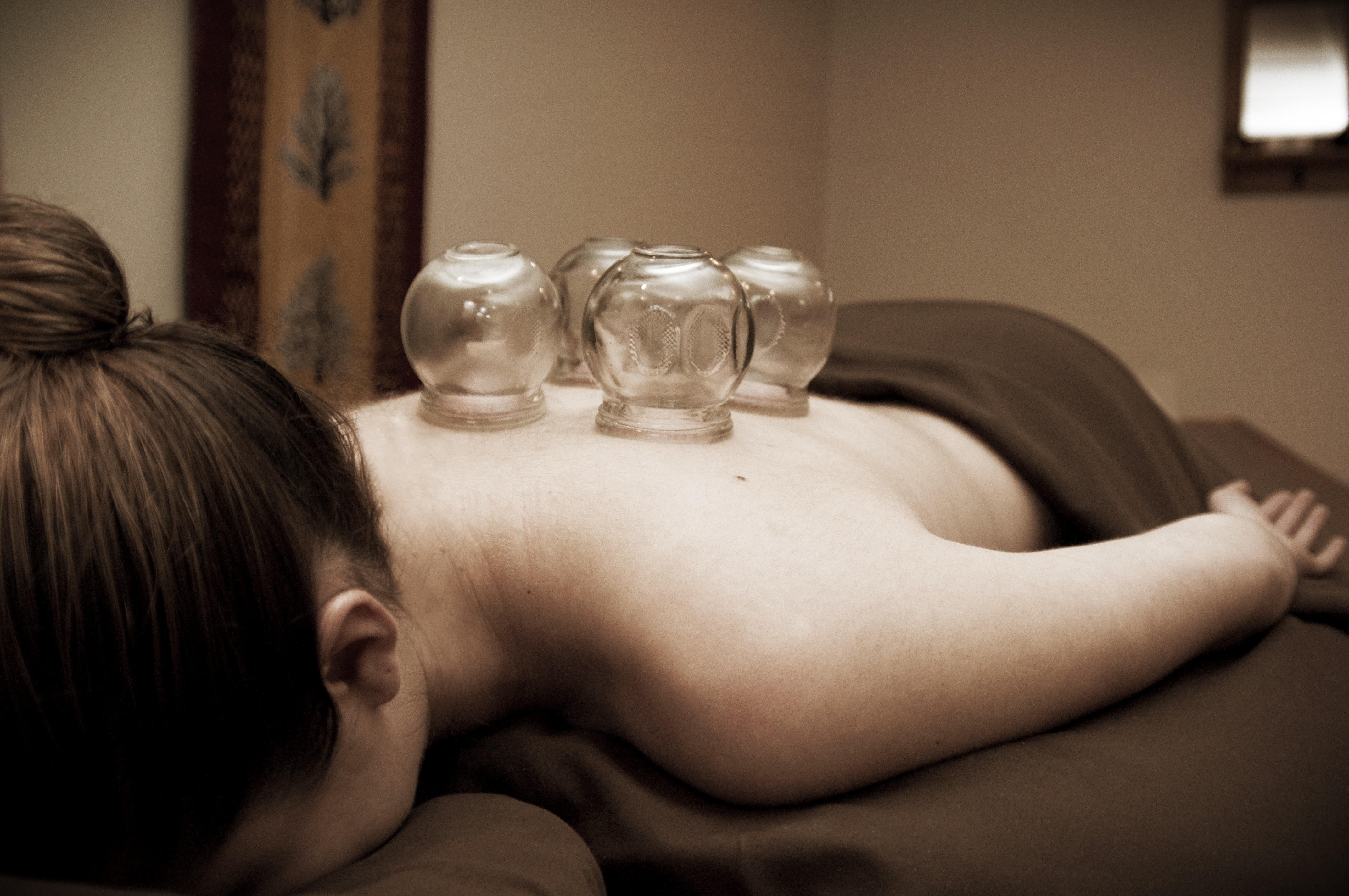 Cupping Therapy